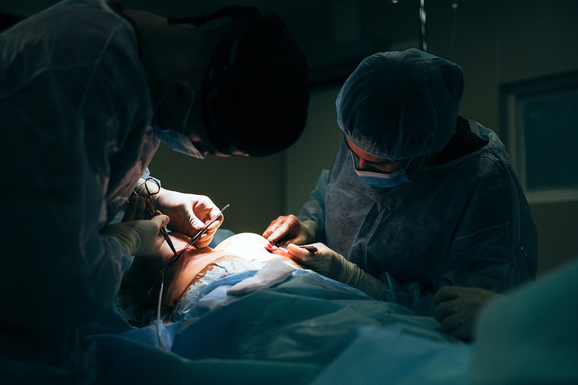 Post Bariatric Surgery - Medi Health Mexico