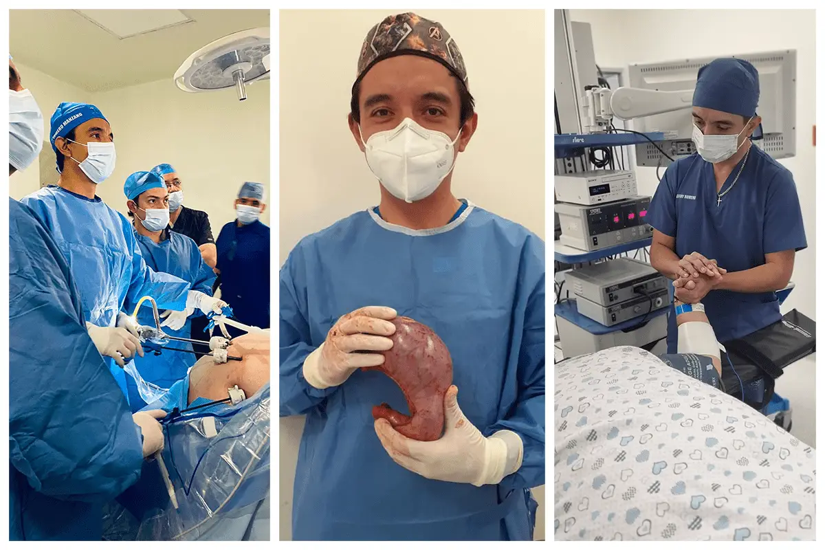 gastric sleeve operation