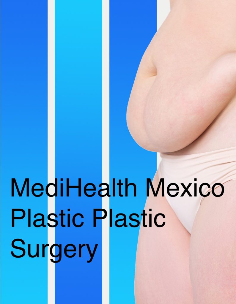 Plastic Surgery Tijuana Mexico