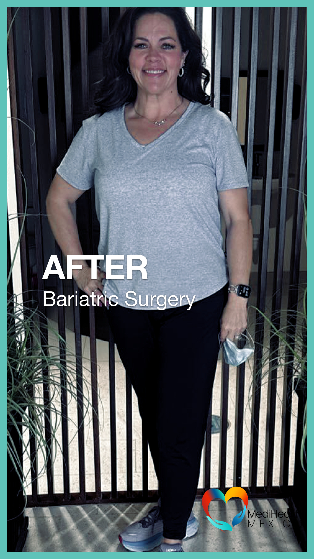 Bariatric Surgery, Plastic Surgery, USA, Tijuana Mexico