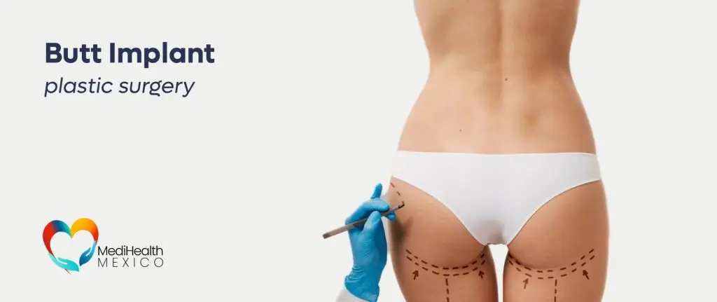 Butt Implants Plastic Surgery MediHealth Mexico