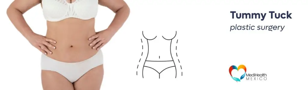 Tummy Tuck Procedures