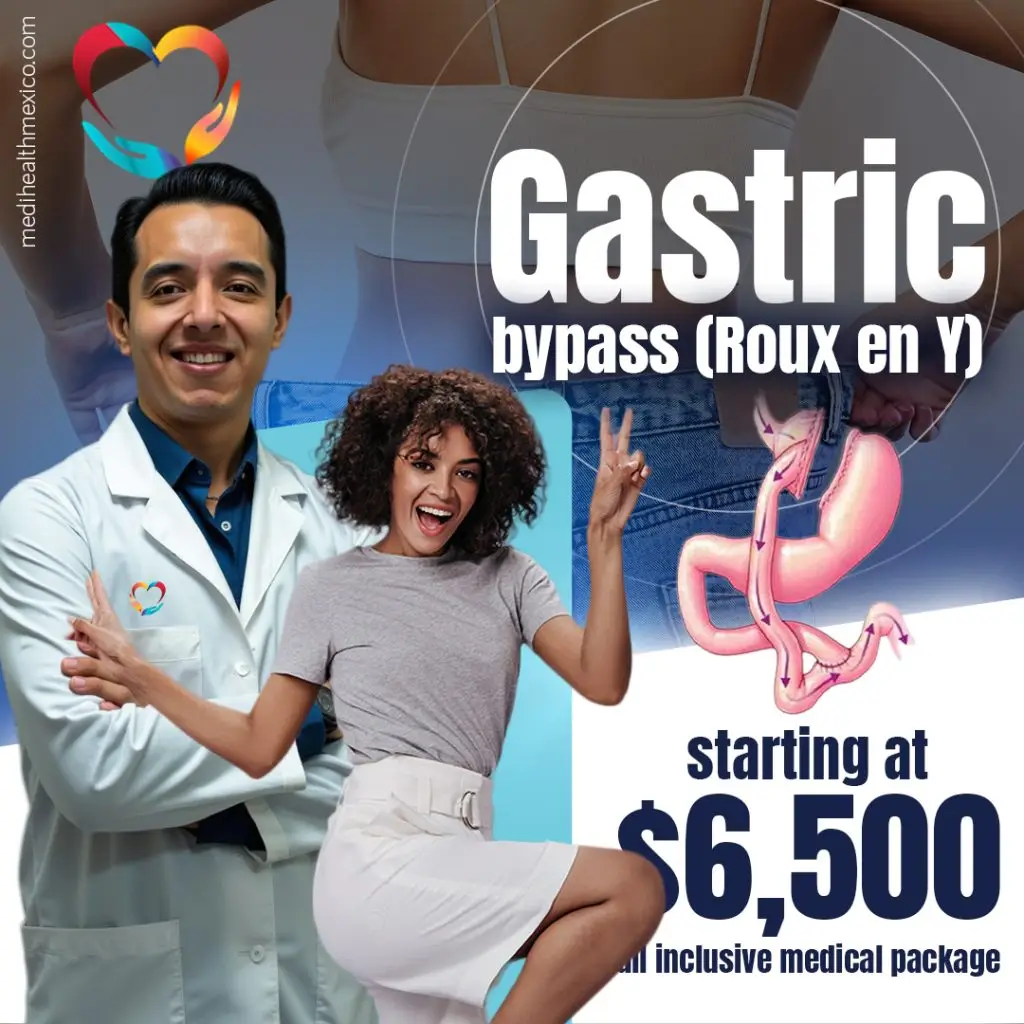 Gastric Bypass