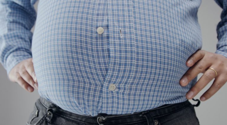 ¿Qué es la cirugía de Gastric Sleeve o manga gástrica? Procedimiento, beneficios y consideraciones
