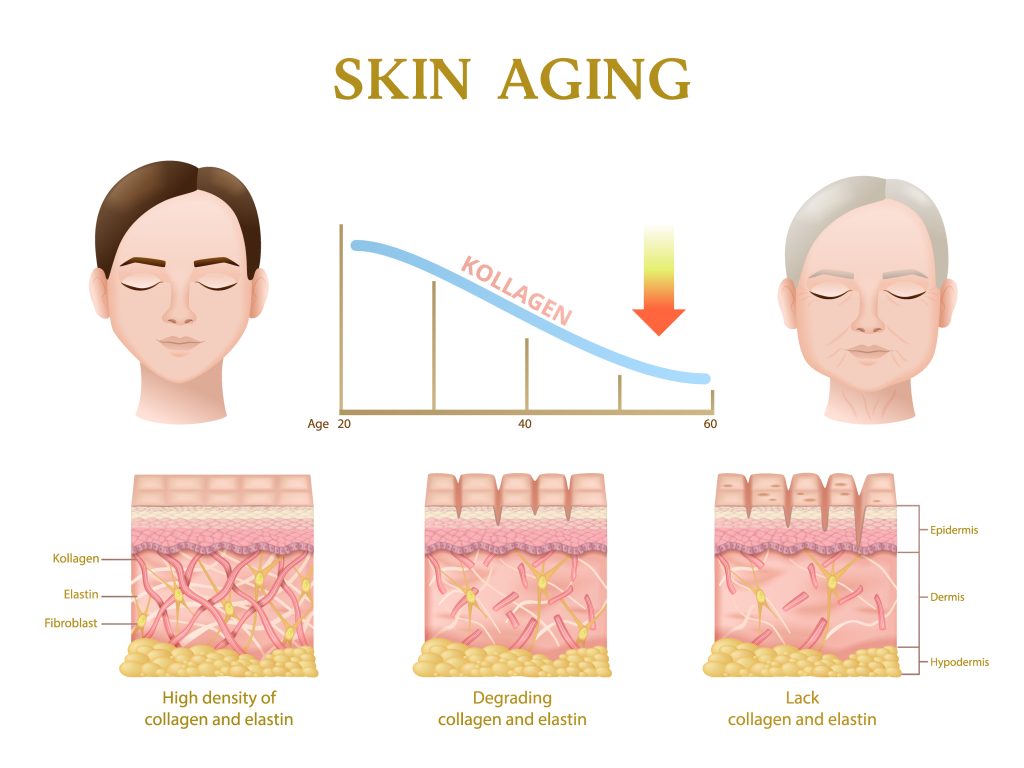 Will Everyone Have Loose Skin After Bariatric Surgery?