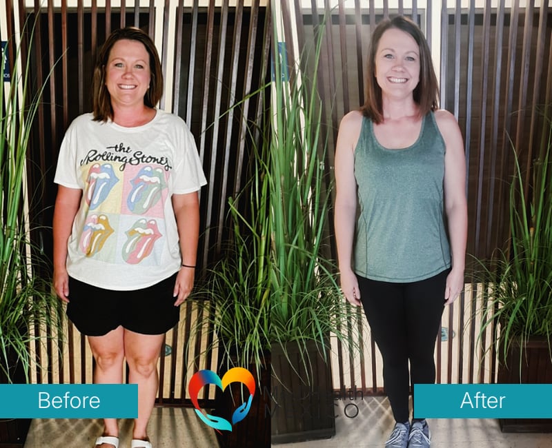 Before and After Bariatric Surgery 0001