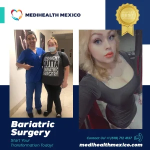 Bariatric Procedure Before and After, MediHealth Mexico