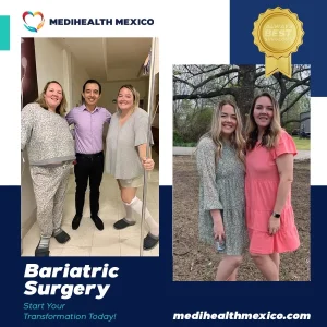 Bariatric Procedure Before and After, MediHealth Mexico