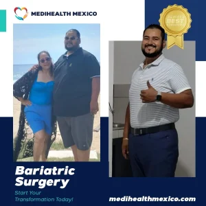 Bariatric Procedure Before and After, MediHealth Mexico