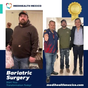 Bariatric Procedure Before and After, MediHealth Mexico