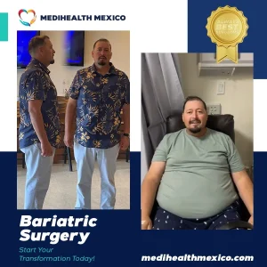 Bariatric Procedure Before and After, MediHealth Mexico