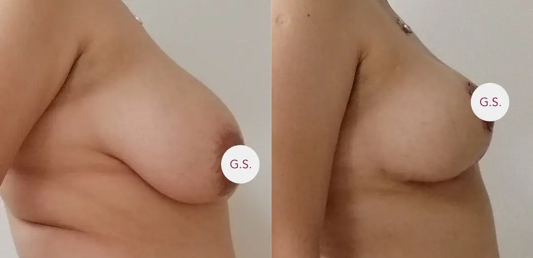 Dr. Sandoval, Plastic Surgeon