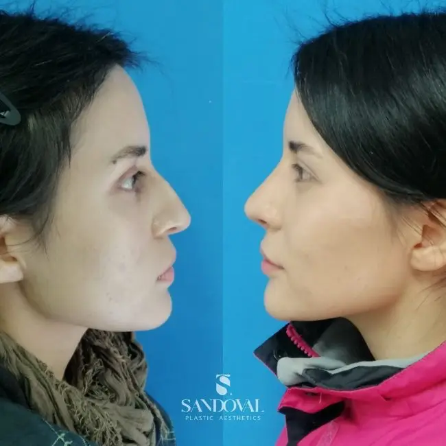 Dr. Sandoval, Plastic Surgeon