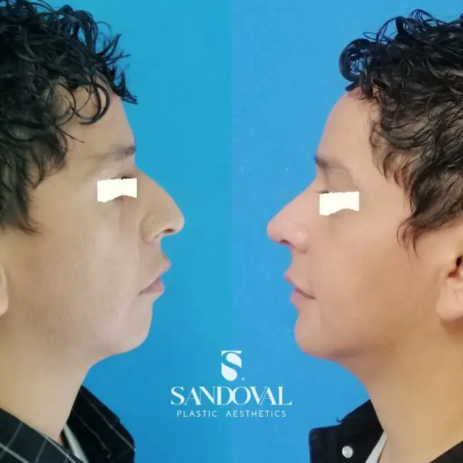 Dr. Sandoval, Plastic Surgeon