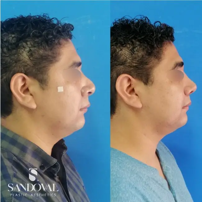 Dr. Sandoval, Plastic Surgeon