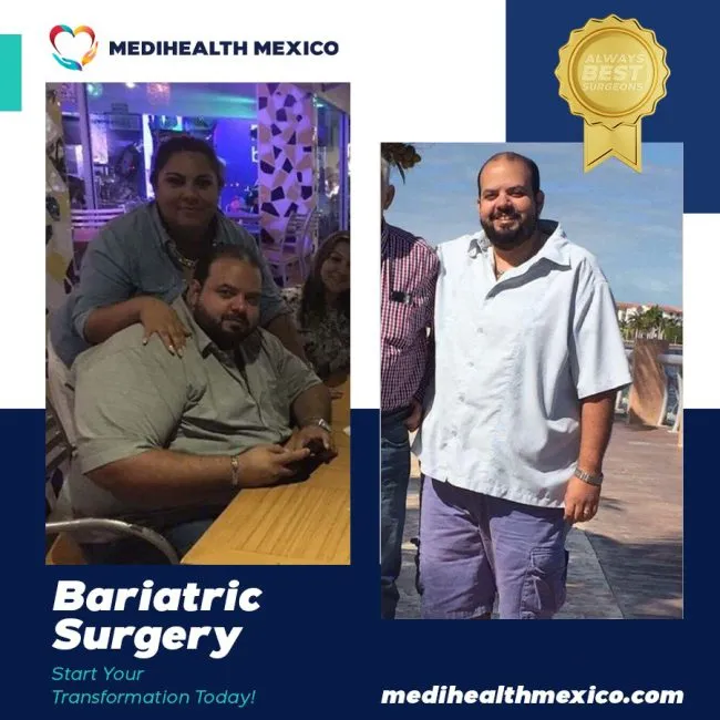 Bariatric Before And After00105