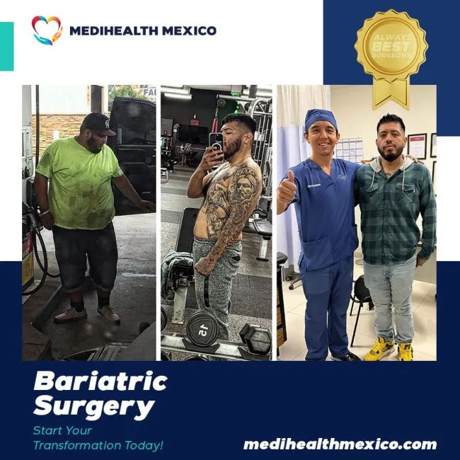 Bariatric Before And After00108