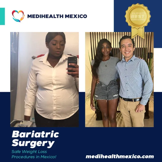 Bariatric Before And After00113