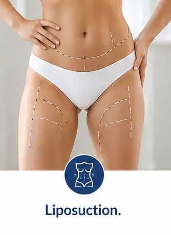 Liposuction