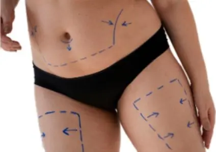 Post Bariatric Content Banner 1024x299 1